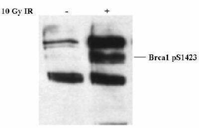 Western Blot: BRCA1 [p Ser1423] Antibody [NB100-226]
